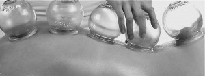 Myofascial Cupping B&W
